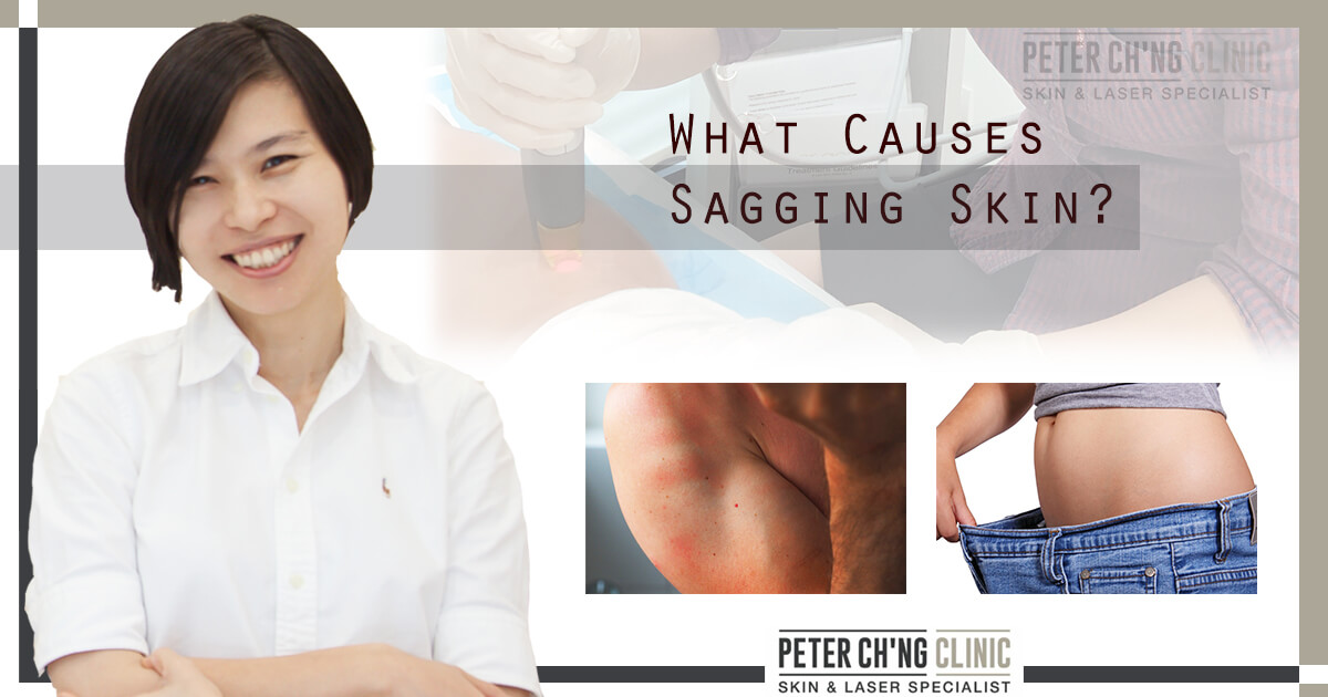 43 Minute What causes saggy upper arms for Beginner