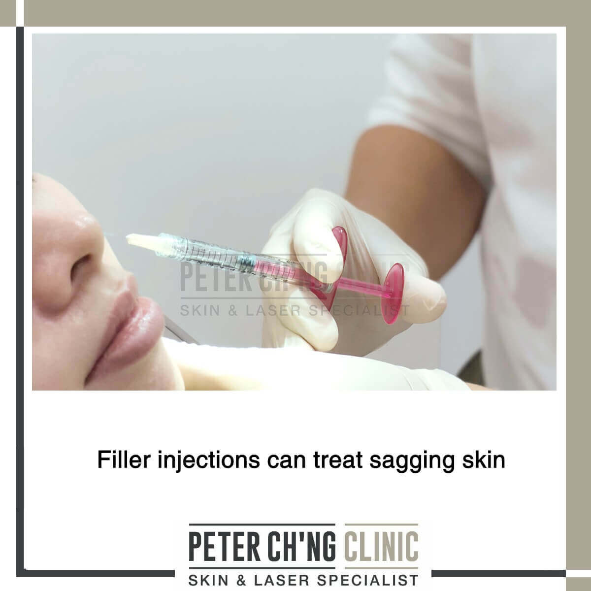 Filler injection