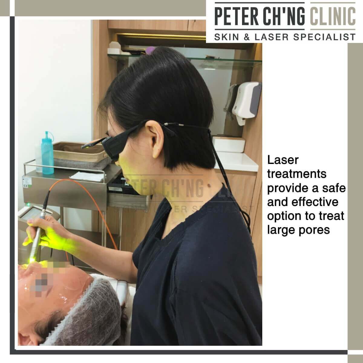 Laser treatment for large pores
