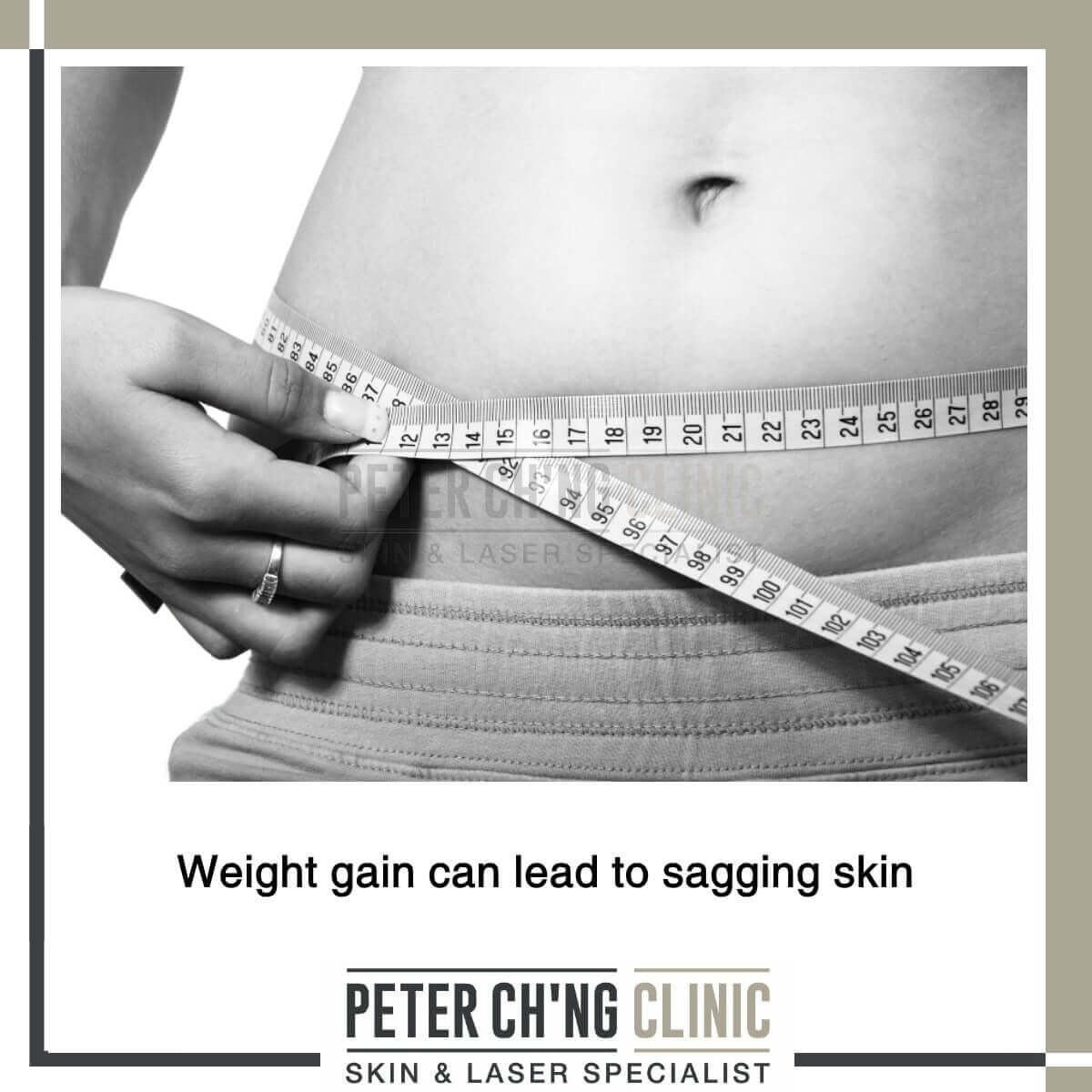 Flabby, Saggin Arms - Why Is It Hard to Lose Fat in Your Upper Arms? -  Atlanta Liposuction Specialty Clinic